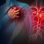 Herzinfarkt: Anzeichen - Symptome - Erste Hilfe und Folgen