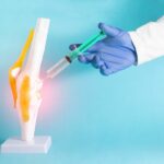 Behandlung von Arthrose durch Autologes Conditioniertes Plasma - kurz ACP