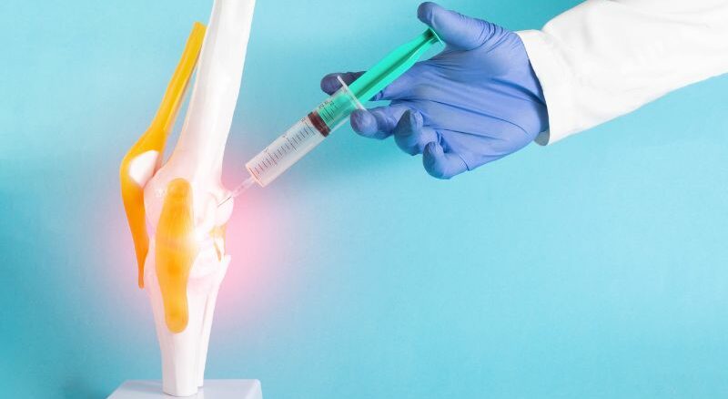Behandlung von Arthrose durch Autologes Conditioniertes Plasma - kurz ACP